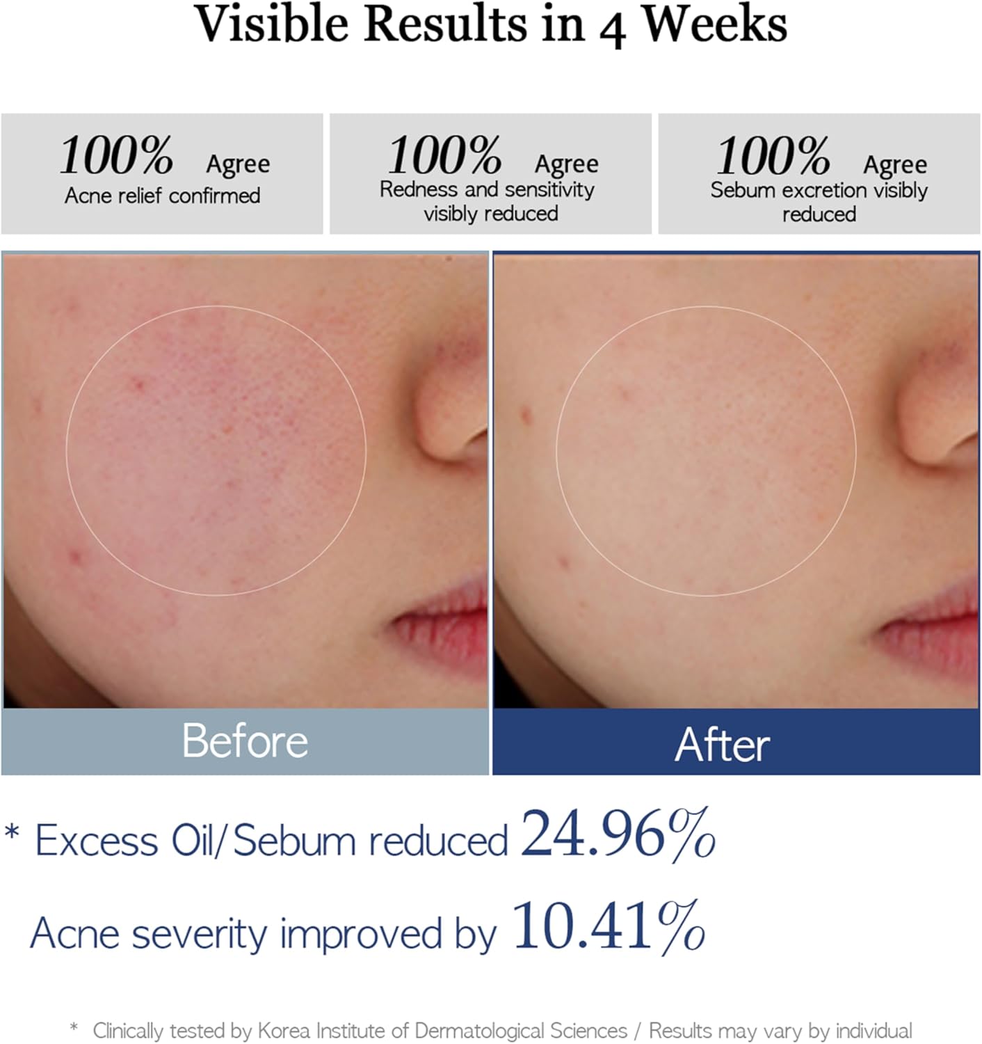 Re.SPN PHA Succinic Acid Calming Toner Pads + Re.SPN Peptide Firming Roller Eye Serum